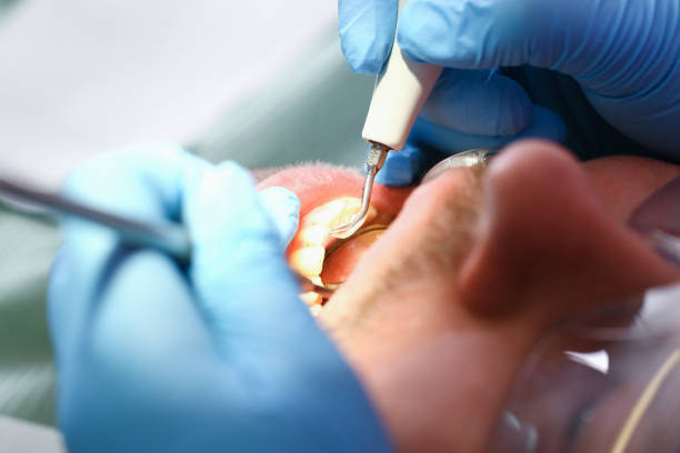 Best Pediatric Emergency Dentist in Greenwood, IN
